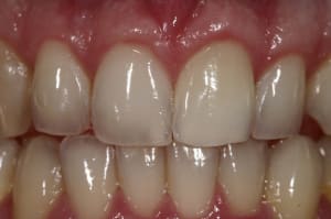 Img 9132 b8neuk - Eugenol