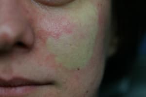 Img 9153 wvex9v - Eugenol
