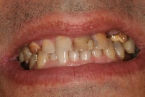 Img 9205 mwixzj - Eugenol