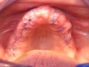 Img 9311 xl1fkp - Eugenol