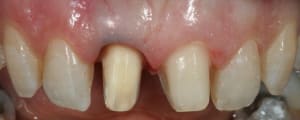 Img 9481 xf4u0b - Eugenol