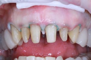 Img 9535 c7wrdc - Eugenol