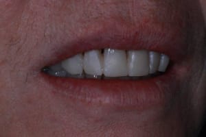 Img 9538 psnywr - Eugenol