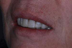 Img 9539 icsz2c - Eugenol