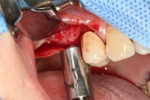 Img 9658 mnrtiw - Eugenol