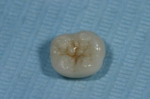 Img 9705 ddivj4 - Eugenol