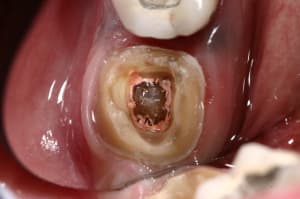 Img 9708 qahegg - Eugenol