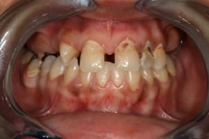 Img 9994 glflbe - Eugenol