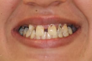 Img 9997 001 chi9xv - Eugenol