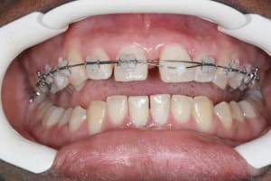 Img duf.m - Eugenol