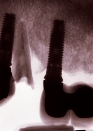 Image0001 xrpgu9 - Eugenol