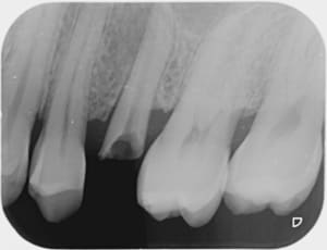 Image000 hyobns - Eugenol