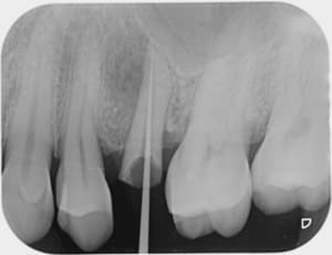 Image001 vcryo9 - Eugenol