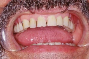 Image10 qgfypz - Eugenol