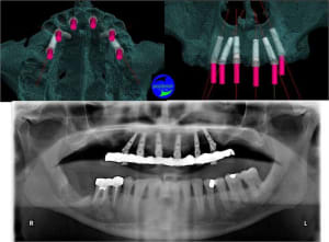 Image2 xlmqet - Eugenol