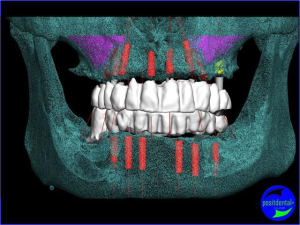 Image3 ku8gvq - Eugenol