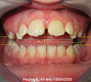 Image3 notzpv - Eugenol