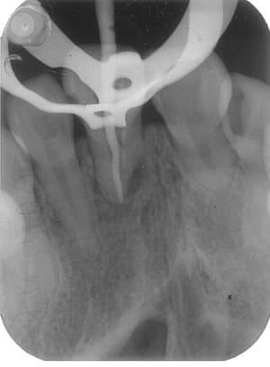 Image3 y4bhqc - Eugenol