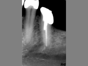 Image4 ugefbn - Eugenol