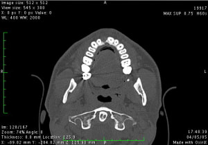 Image5 frcyrd - Eugenol