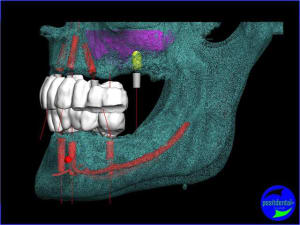 Image5 zt9ege - Eugenol