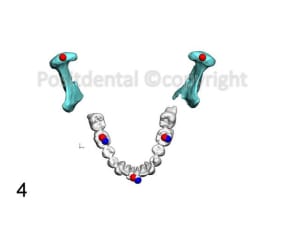 Image6 btuz6g - Eugenol