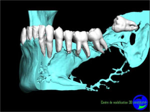 Image8 v2w8xi - Eugenol