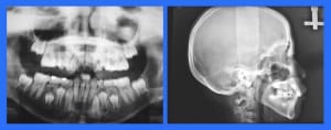 Image 1 wasfvq - Eugenol