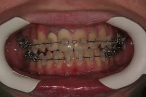 Image 3 xdhlmk - Eugenol