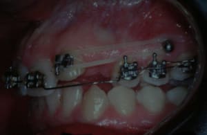 Img 1981 jshylk - Eugenol