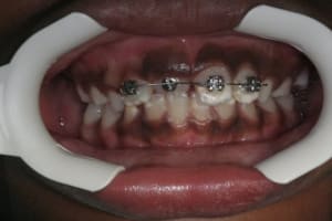 Img 3999 wgsf6j - Eugenol
