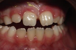 Img 8254 a3c4nj - Eugenol