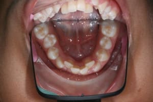 Img 9861 ogyvix - Eugenol
