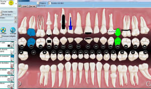 Julie dent absente1 ylrh4t - Eugenol