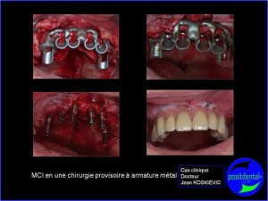K4 puquvc - Eugenol