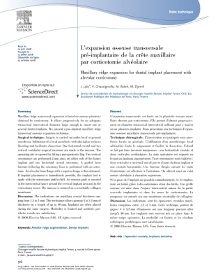 Lalo2008 jt2u1n - Eugenol
