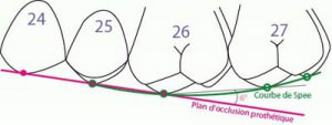 Le montage des dents plan d occlusion proth tique et courbe de spee z7gv0e - Eugenol