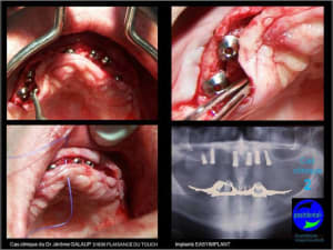 Mcd mise en charge diff r e06 xvnycm - Eugenol