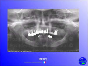 Mci  mise en charge imm diate  chirurgie implantaire guid e 001 hcexxs - Eugenol