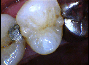 Md740 hxbgcr - Eugenol