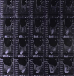Mfscan3 ztwf2e - Eugenol