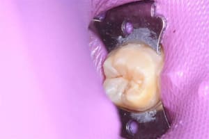 Mih 003  medium  q6ruwo - Eugenol