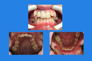 Montage 1 auzs7l - Eugenol