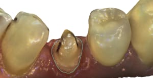 Mandibule 56 id85 dy6me9 - Eugenol