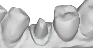 Mandibule 57 id85 b9zrqe - Eugenol