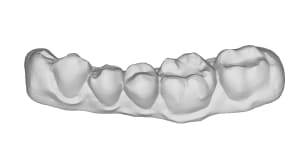 Mandibule 5 id62 zncaje - Eugenol