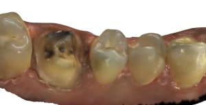 Maxillaire 4 id62 ajtszq - Eugenol