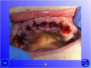 Mise en chage imm diate 010 eaavmn - Eugenol