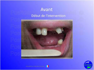 Mise en chage imm diate 032 slcwxl - Eugenol