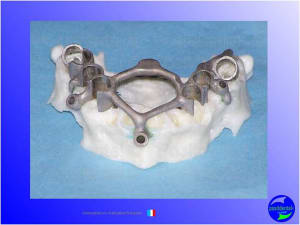 Mise en chage imm diate 037 idesdw - Eugenol